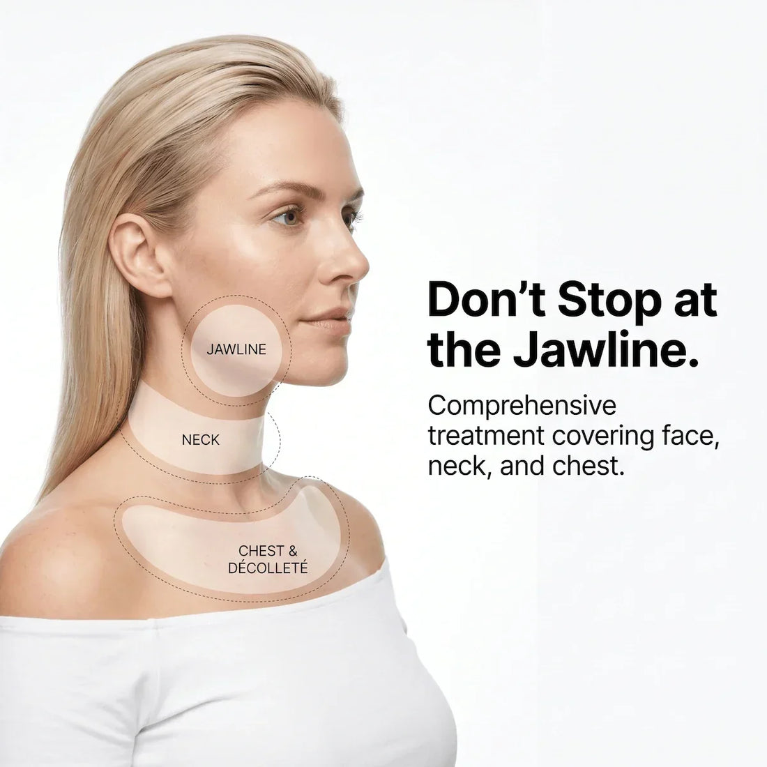 Profile view of a model highlighting the comprehensive treatment coverage of the Elevaure system across the face, jawline, neck, and chest.