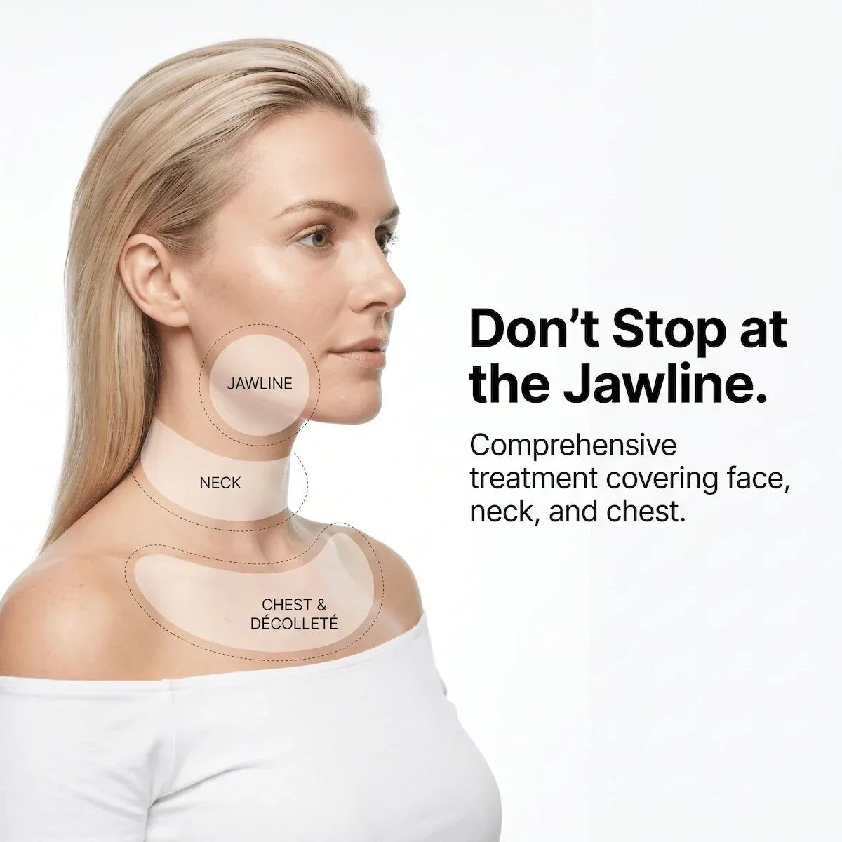 Profile view of a model highlighting the comprehensive treatment coverage of the Elevaure system across the face, jawline, neck, and chest.