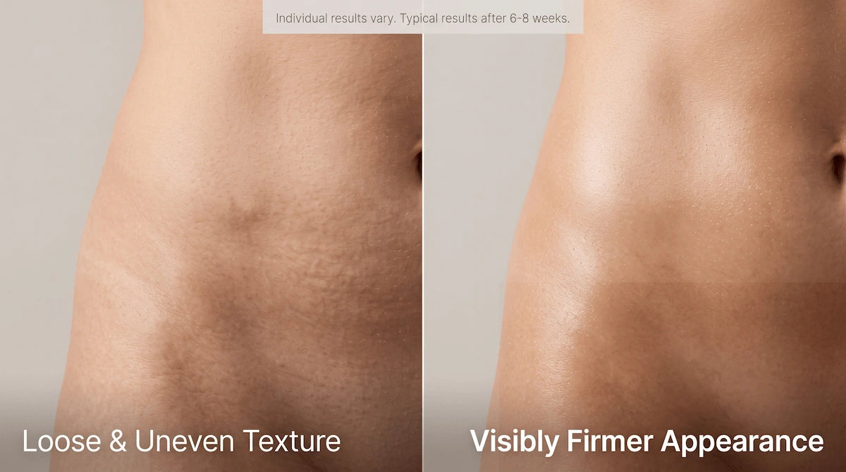 Close-up comparison of abdomen skin texture and firmness before and after a 6-week professional home body sculpting routine.