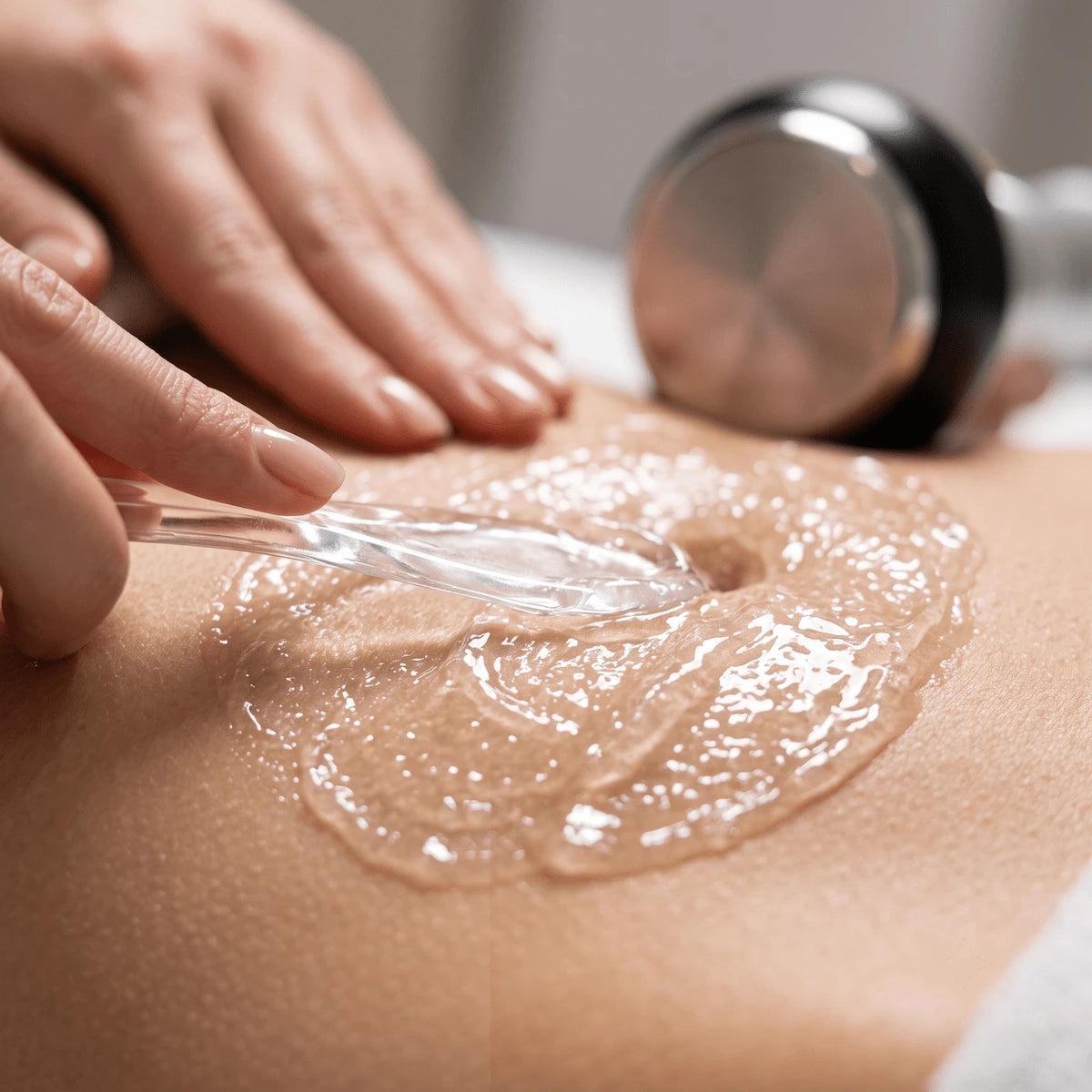 Applying a generous layer of clear conductive gel to the abdomen to ensure smooth probe gliding and energy delivery.