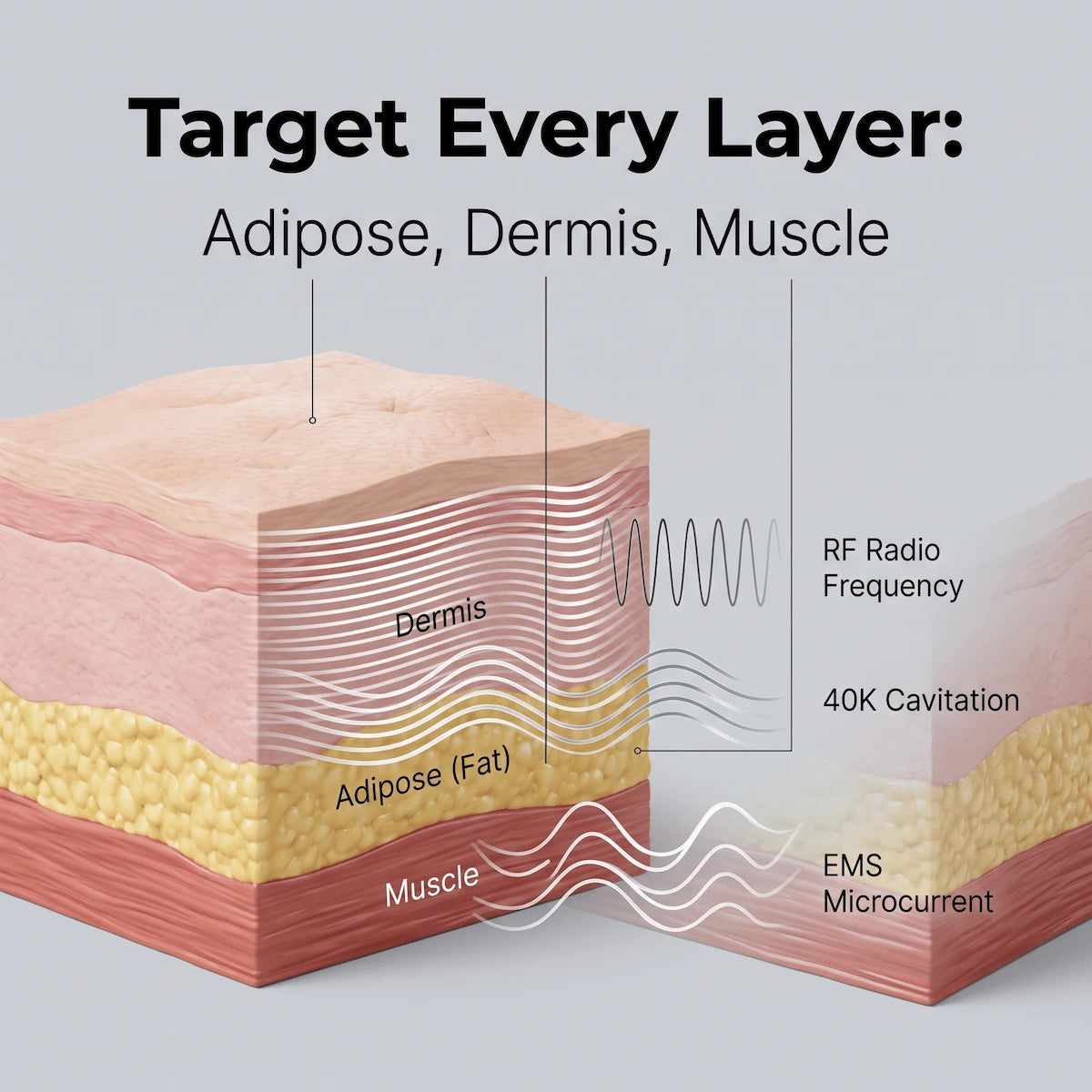 3D scientific diagram showing how Elevaure targets fat, skin, and muscle layers.