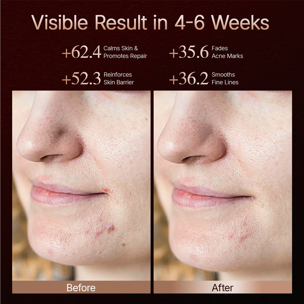 Before and after close-up of facial skin texture showing visible calming and reduced blemish marks over 4 to 6 weeks.