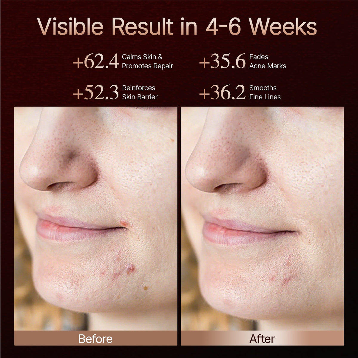 Before and after skin comparison showing reduced fine line depth and improved skin firmness after consistent Red 630nm and NIR 850nm LED face mask sessions at 3x weekly protocol over 12 weeks.