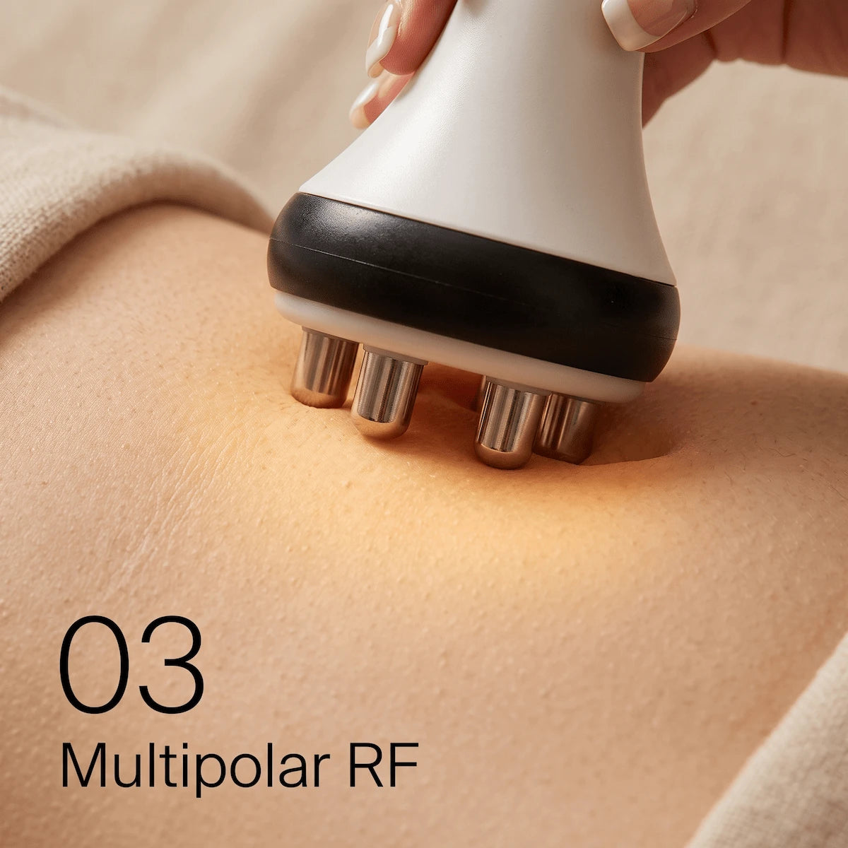 Step 3: Multipolar RF skin tightening application.
