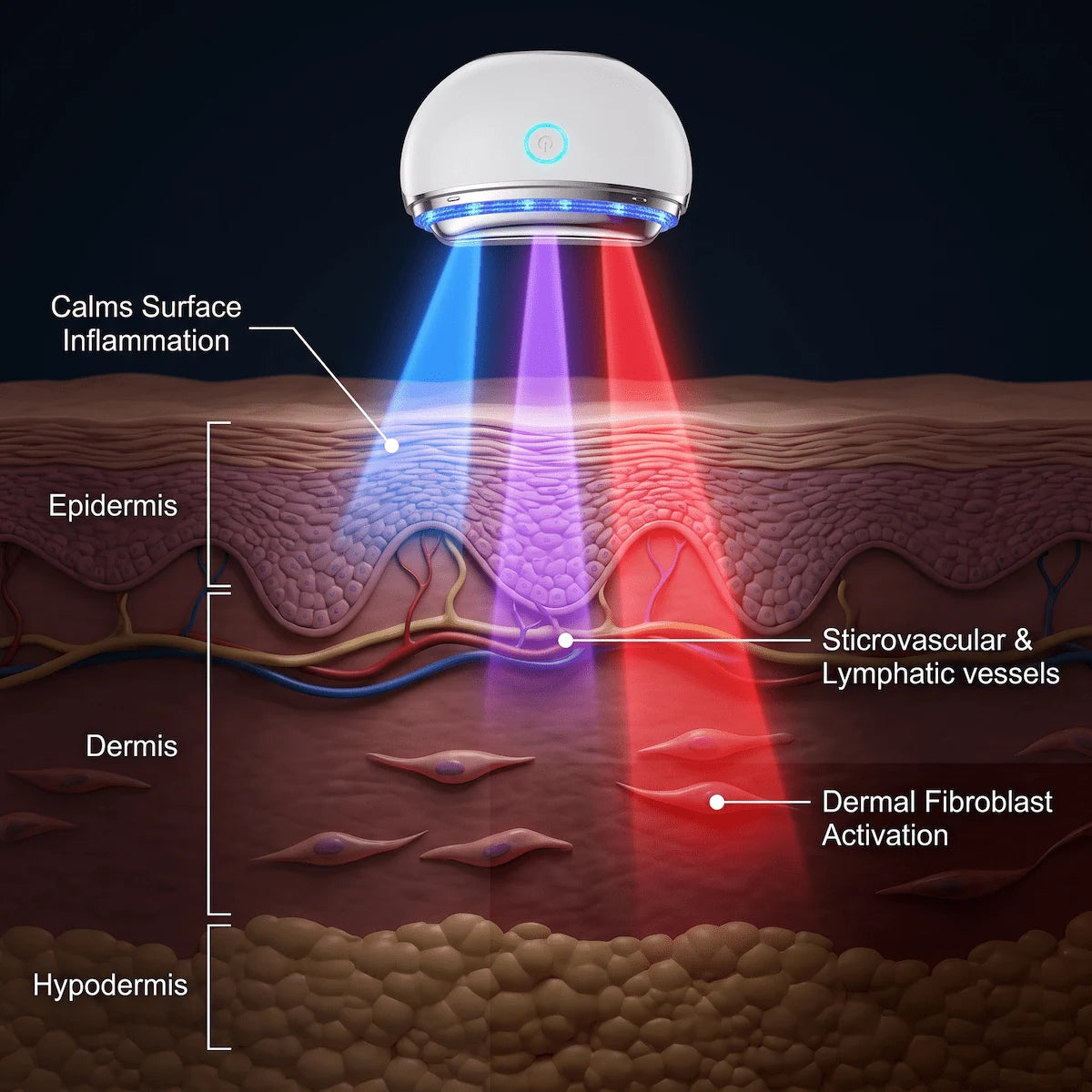 3D skin diagram showing the different penetration depths of blue, violet, and red LED light therapy for various skin concerns.