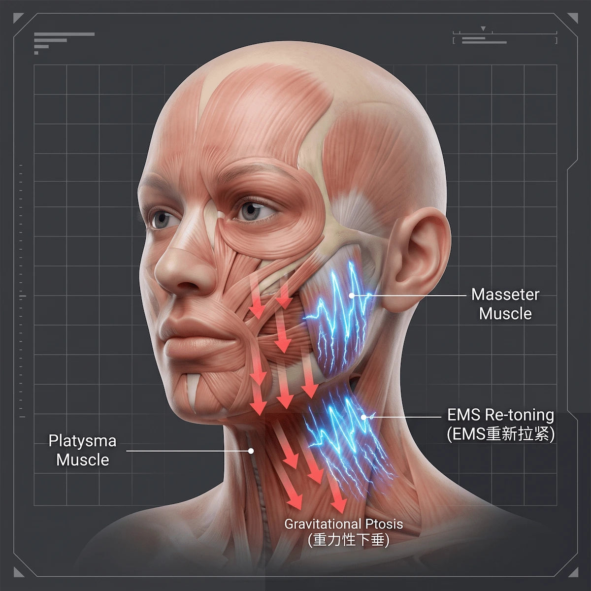 3D anatomical diagram showing platysma muscle atrophy causing jawline sagging and how EMS microcurrent re-tones the structure.