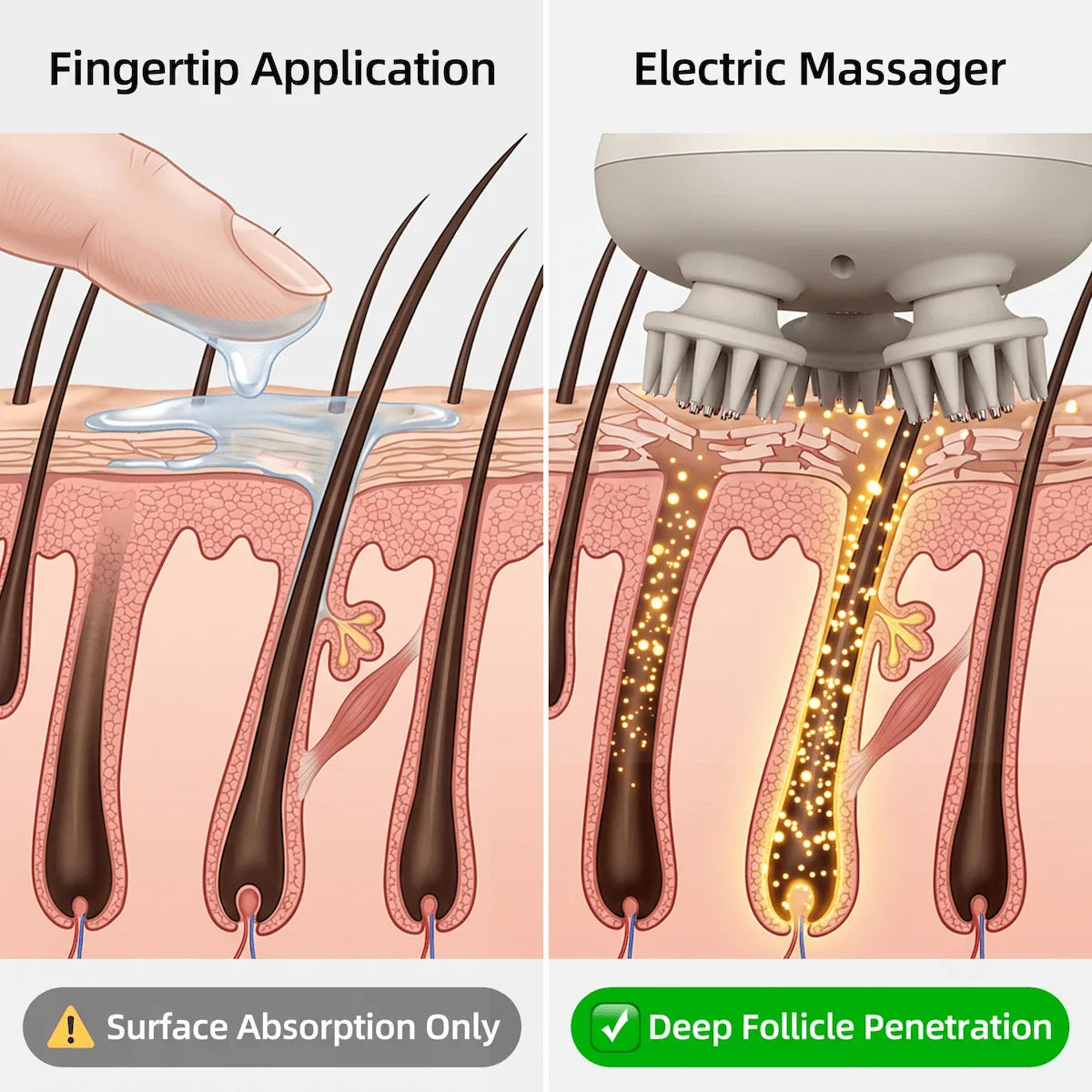 Diagram showing how an electric scalp massager pushes hair growth serums deeper into the follicle compared to manual application.