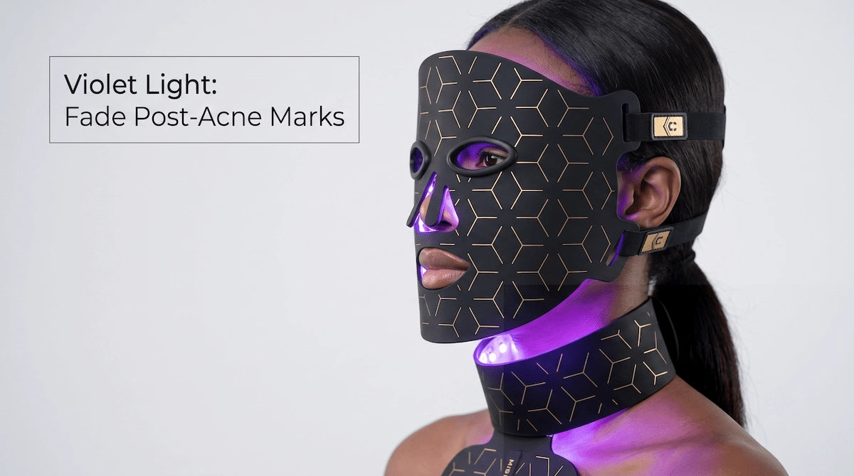 Woman with deeper skin tone using violet LED light therapy to safely fade post-inflammatory hyperpigmentation and acne dark spots.
